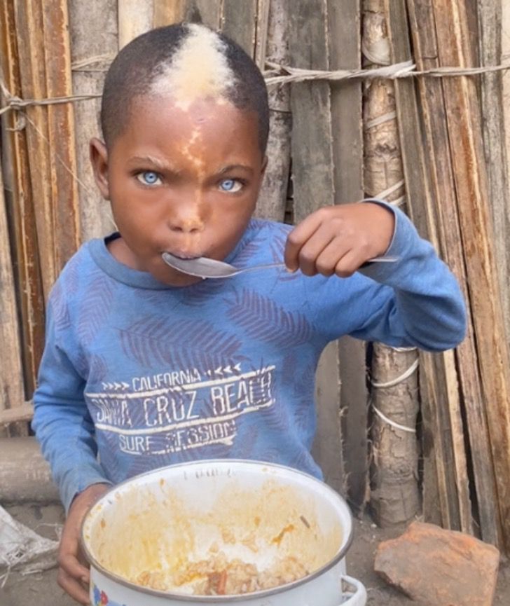 revistapazes.com - "É um ser de luz", diz fotógrafo que fez ensaio de menino com olhos azuis e marca de nascença em "relâmpago"