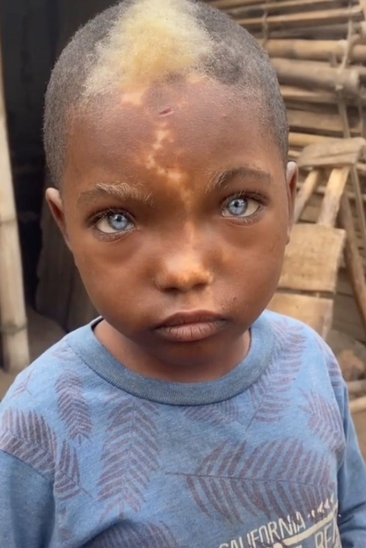 revistapazes.com - "É um ser de luz", diz fotógrafo que fez ensaio de menino com olhos azuis e marca de nascença em "relâmpago"