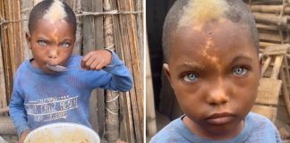 “É um ser de luz”, diz fotógrafo que fez ensaio de menino com olhos azuis e marca de nascença em “relâmpago”