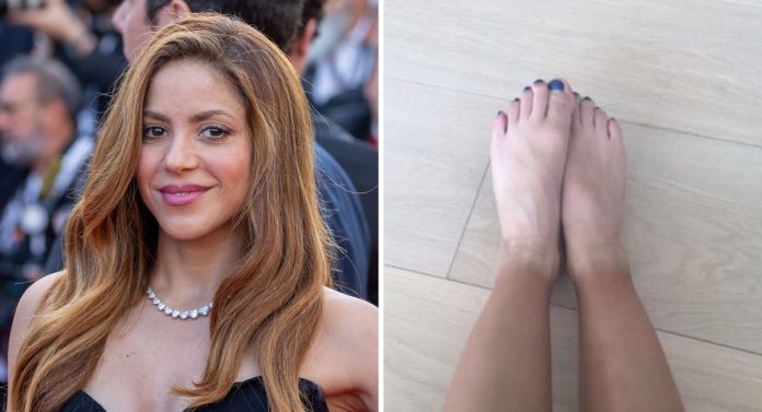 O dia em que Shakira postou uma foto com os pés descalços no Instagram e foi bombardeada de críticas