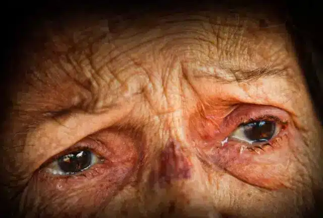 Idosa que era agredida todos os dias pelo filho dependente químico tem "esperança" de vê-lo solto revistapazes.com - Idosa que era agredida todos os dias pelo filho dependente químico tem "esperança" de vê-lo solto