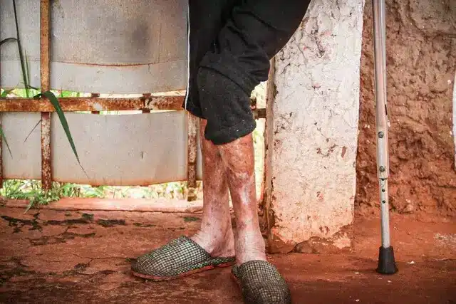 Idosa que era agredida todos os dias pelo filho dependente químico tem "esperança" de vê-lo solto revistapazes.com - Idosa que era agredida todos os dias pelo filho dependente químico tem "esperança" de vê-lo solto