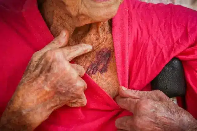 Idosa que era agredida todos os dias pelo filho dependente químico tem "esperança" de vê-lo solto revistapazes.com - Idosa que era agredida todos os dias pelo filho dependente químico tem "esperança" de vê-lo solto