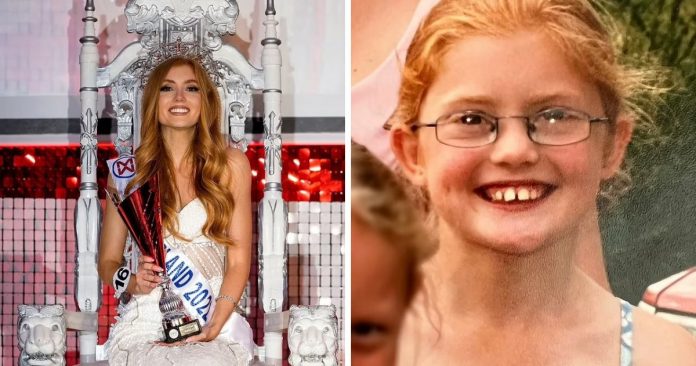 Engenheira aeroespacial que era alvo de bullying na escola por ser ruiva vence Miss Inglaterra
