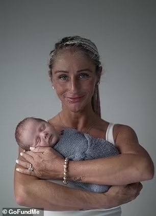 revistapazes.com - Bebê de 3 semanas morre sufocado por sling enrolado em sua barriga