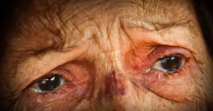 Idosa que era agredida todos os dias pelo filho dependente químico tem “esperança” de vê-lo solto