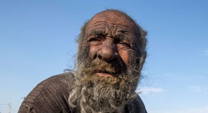 “Homem mais sujo do mundo” falece aos 94, após ficar mais de meio século sem tomar banho
