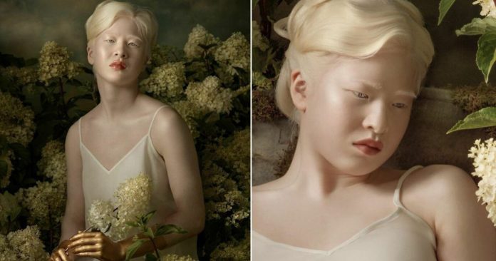 Abandonada por ter albinismo, chinesa de 16 anos vira modelo e brilha na Vogue Itália; veja as fotos