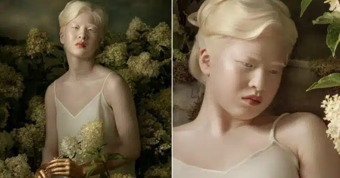 CAPA - 2022-11-03T155453.616 Abandonada por ter albinismo, chinesa de 16 anos vira modelo e brilha na Vogue Itália; veja as fotos