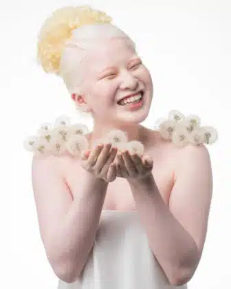 Abandonada por ter albinismo, chinesa de 16 anos vira modelo e brilha na Vogue Itália; veja as fotos revistapazes.com - Abandonada por ter albinismo, chinesa de 16 anos vira modelo e brilha na Vogue Itália; veja as fotos