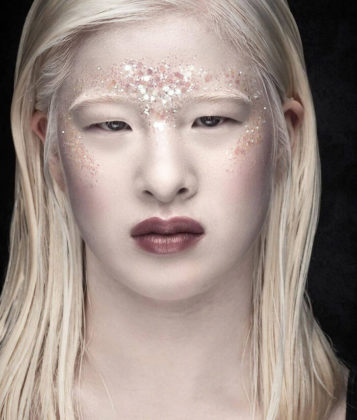 revistapazes.com - Abandonada por ter albinismo, chinesa de 16 anos vira modelo e brilha na Vogue Itália; veja as fotos