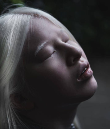 revistapazes.com - Abandonada por ter albinismo, chinesa de 16 anos vira modelo e brilha na Vogue Itália; veja as fotos