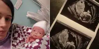 Mãe dá à luz filho dias depois de médicos dizerem que ele havia morrido em seu útero