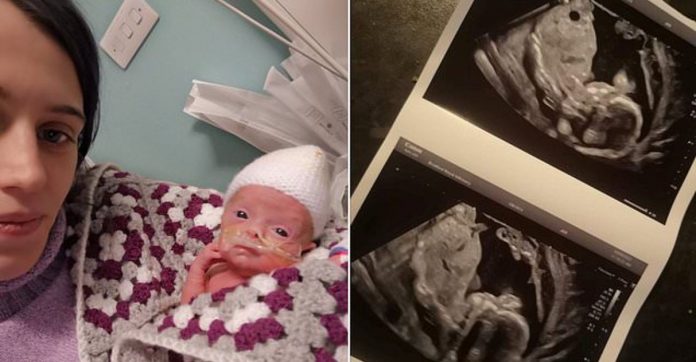 Mãe dá à luz filho dias depois de médicos dizerem que ele havia morrido em seu útero