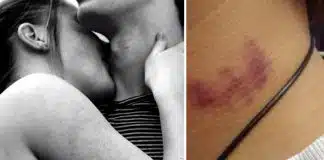 Mulher exagera em chupão no pescoço e acaba matando o próprio namorado – entenda!