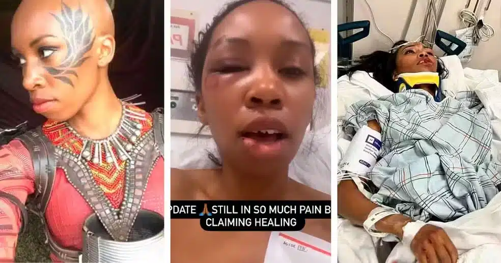 Estrela de 'Pantera Negra' é internada em estado gravíssimo após acidente com perseguição policial revistapazes.com - Estrela de 'Pantera Negra' é internada em estado gravíssimo após acidente com perseguição policial