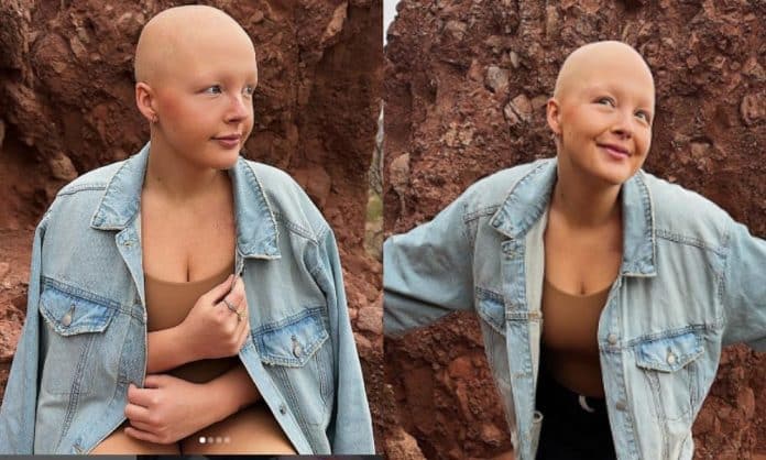 Morre Maddy Baloy, TikToker de 26 anos que compartilhou sua luta contra o câncer terminal