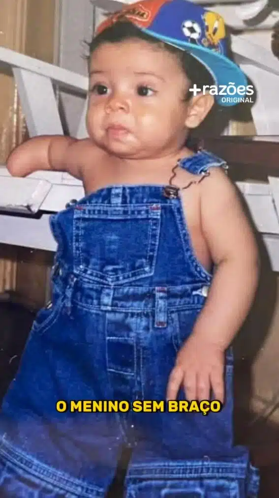 "Me chamavam de menino sem braço, e hoje ajudo crianças com deficiência a serem ouvidas e respeitadas" - LEIA O RELATO revistapazes.com - "Me chamavam de menino sem braço, e hoje ajudo crianças com deficiência a serem ouvidas e respeitadas" - LEIA O RELATO