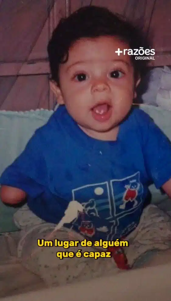 "Me chamavam de menino sem braço, e hoje ajudo crianças com deficiência a serem ouvidas e respeitadas" - LEIA O RELATO revistapazes.com - "Me chamavam de menino sem braço, e hoje ajudo crianças com deficiência a serem ouvidas e respeitadas" - LEIA O RELATO