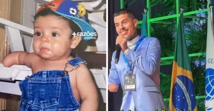 gpgc-thumb “Me chamavam de menino sem braço, e hoje ajudo crianças com deficiência a serem ouvidas e respeitadas” – LEIA O RELATO