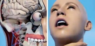 Simulação assustadora de como um dente pode te matar está tirando o sono das pessoas