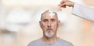 9 sinais de Alzheimer: como identificar os sintomas precoce (antes que seja tarde demais)