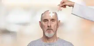 9 sinais de Alzheimer: como identificar os sintomas precoce (antes que seja tarde demais)