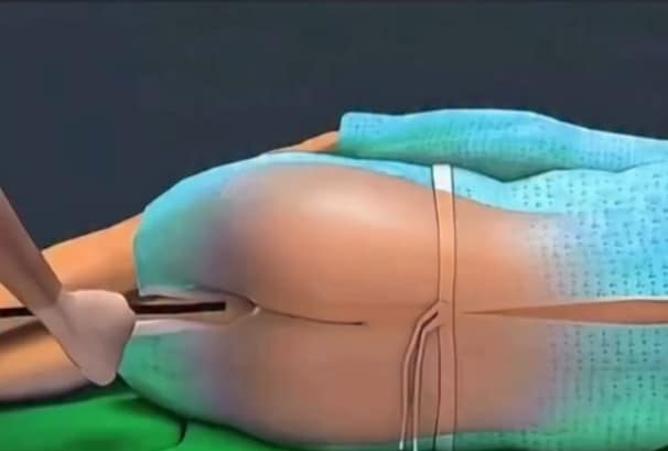 revistapazes.com - 30 anos, 45 ou 60? M&eacute;dico brasileiro explica qual &eacute; a idade ideal para marcar colonoscopia e faz alerta