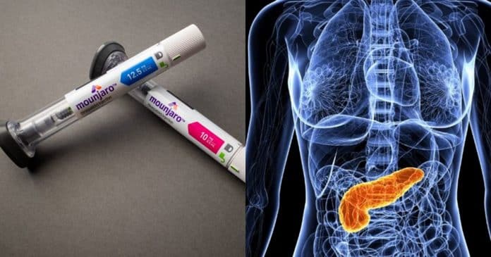 O que está por trás dos casos de pancreatite investigados em milhares de usuárias de canetas emagrecedoras