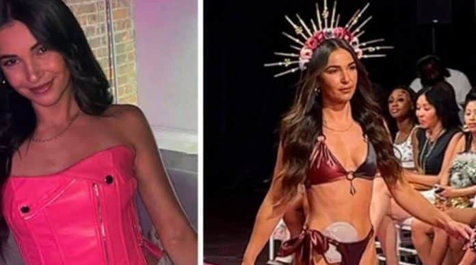 “Não tenho nada a esconder”: a história da modelo que levou sua ostomia para a passarela
