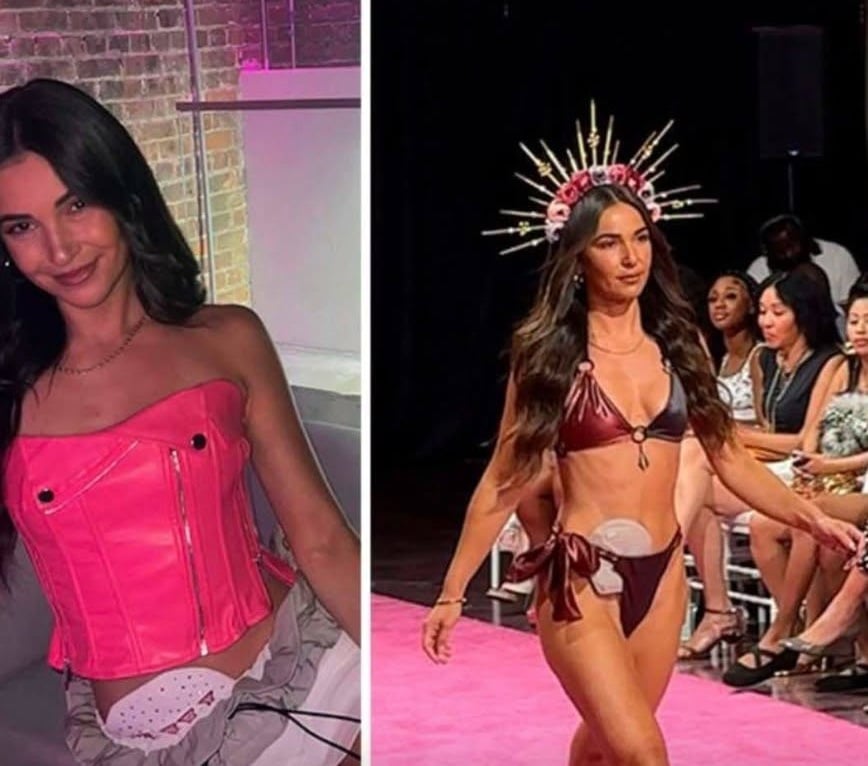 revistapazes.com - &ldquo;N&atilde;o tenho nada a esconder&rdquo;: a hist&oacute;ria da modelo que levou sua ostomia para a passarela