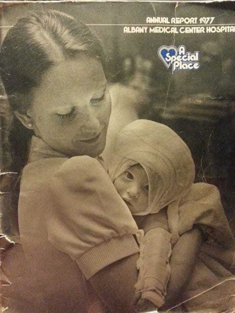 revistapazes.com - Em 1977, uma enfermeira salvou um beb&ecirc; gravemente queimado. 38 anos depois, ela viu uma antiga foto no Facebook e ficou paralisada