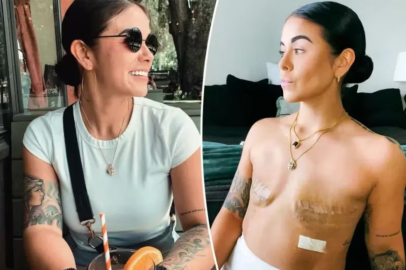 revistapazes.com - Sem diagn&oacute;stico de c&acirc;ncer, mulher de 27 anos tomou uma decis&atilde;o radical ap&oacute;s exame gen&eacute;tico