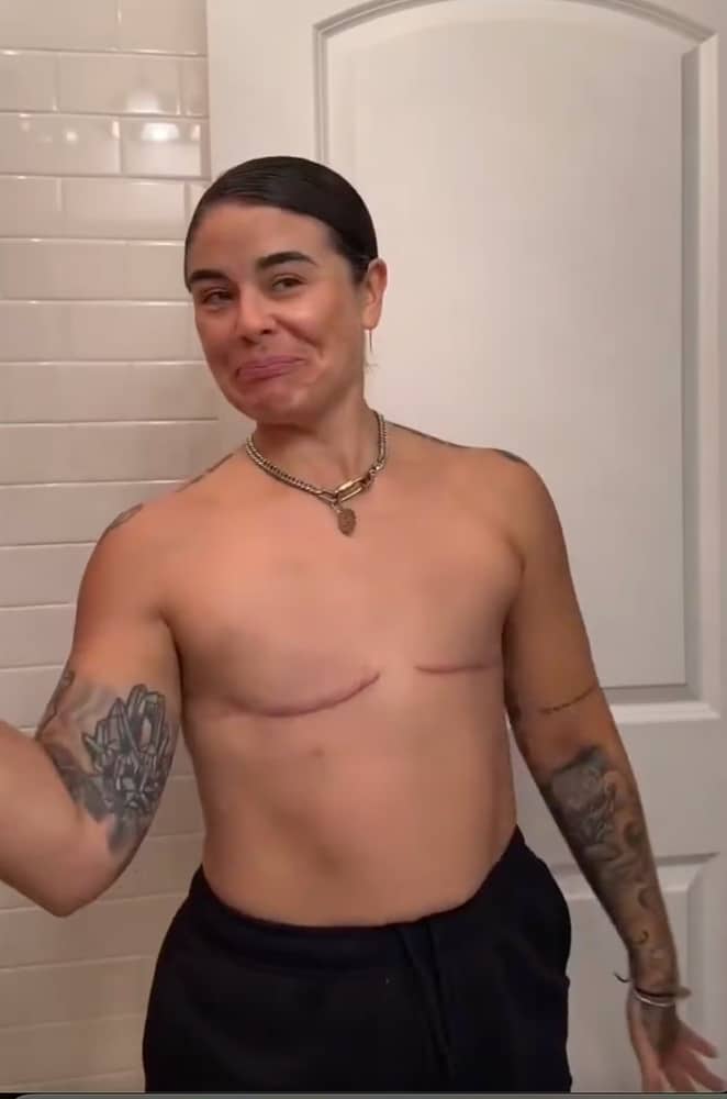 revistapazes.com - Sem diagn&oacute;stico de c&acirc;ncer, mulher de 27 anos tomou uma decis&atilde;o radical ap&oacute;s exame gen&eacute;tico