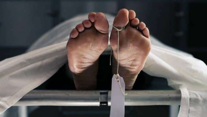 Pessoas ficam horrorizadas ao descobrir que uma parte do corpo é sempre removida durante uma autópsia