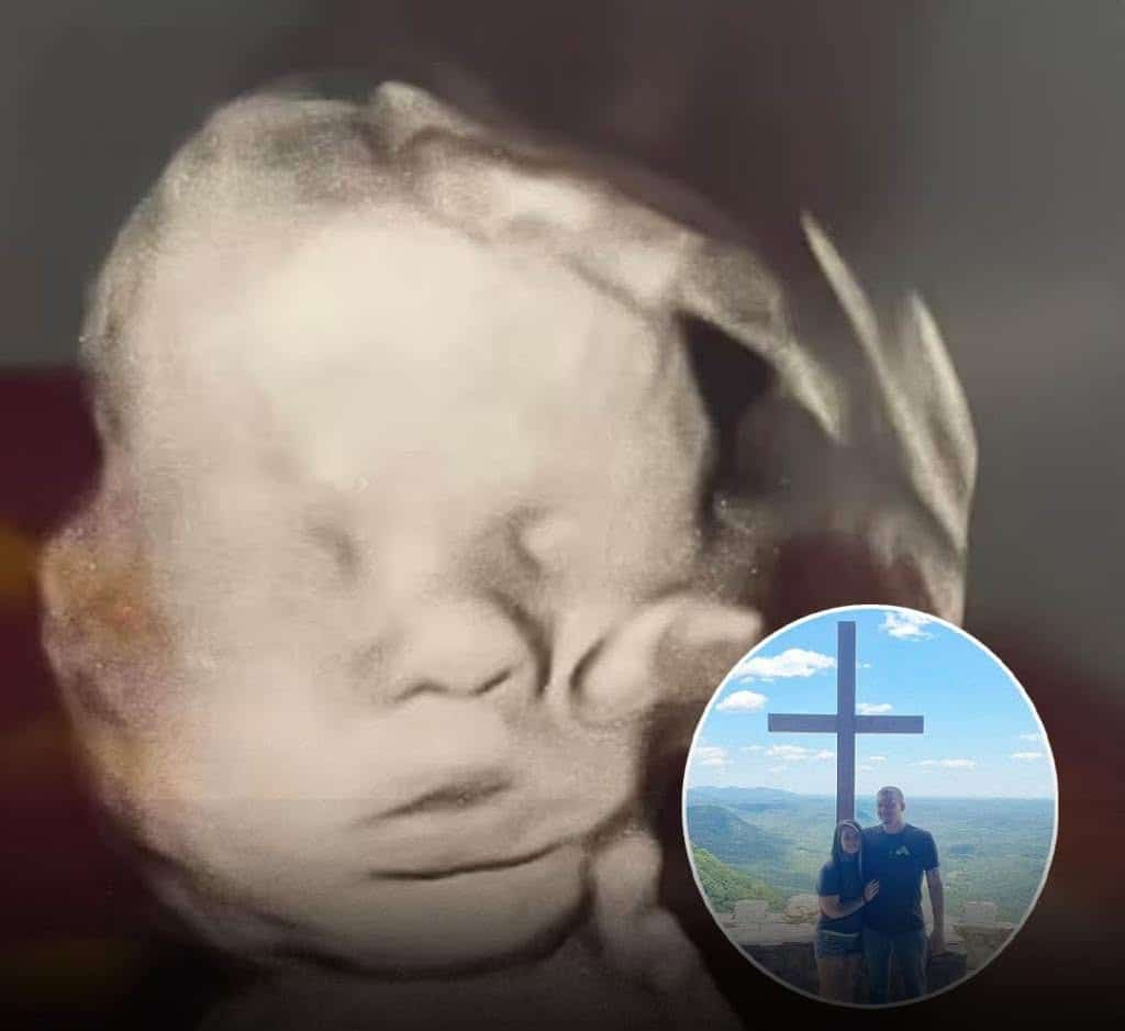 revistapazes.com - &lsquo;A m&atilde;o de Deus&rsquo; aparece misteriosamente em ultrassonografia ap&oacute;s m&atilde;e rezar pela sa&uacute;de do beb&ecirc;