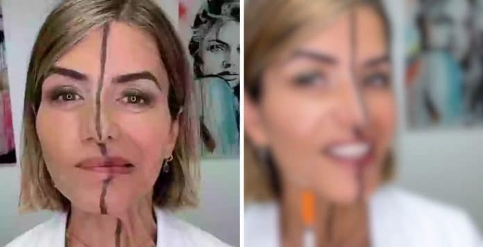 Esta é a médica que aplicou botox em apenas metade do rosto… Sente-se antes de vê-la hoje!