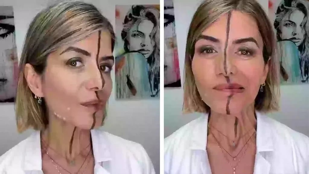 revistapazes.com - Esta &eacute; a m&eacute;dica que aplicou botox em apenas metade do rosto... Sente-se antes de v&ecirc;-la hoje!