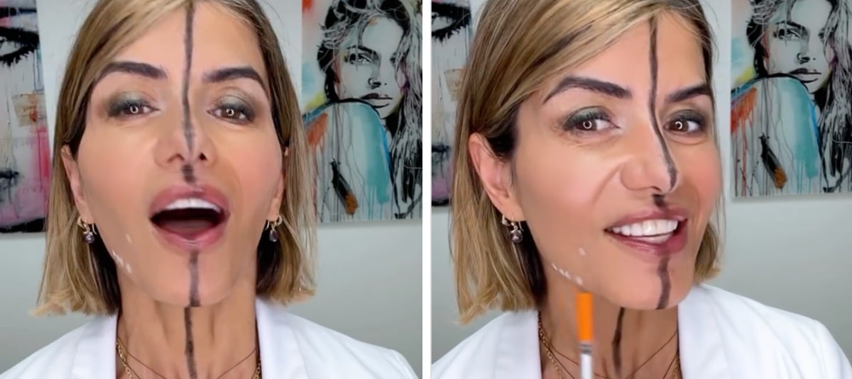 revistapazes.com - Esta &eacute; a m&eacute;dica que aplicou botox em apenas metade do rosto... Sente-se antes de v&ecirc;-la hoje!