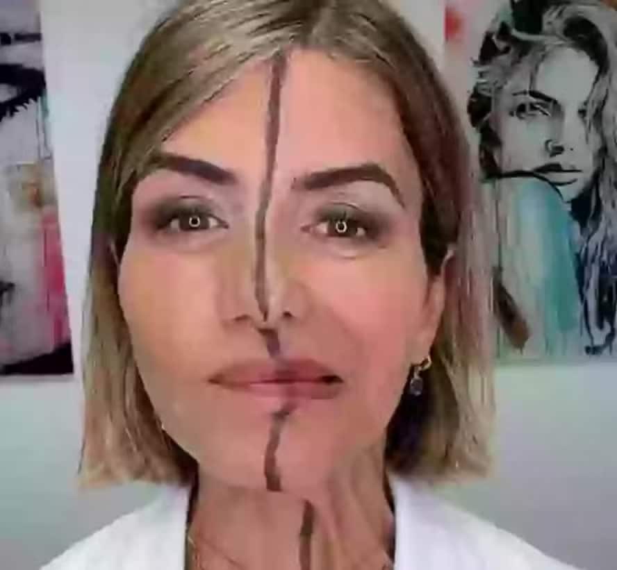 revistapazes.com - Esta &eacute; a m&eacute;dica que aplicou botox em apenas metade do rosto... Sente-se antes de v&ecirc;-la hoje!