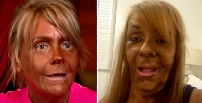 Ela virou notícia por um bronzeado extremo; anos depois, Patricia Krentcil reaparece diferente