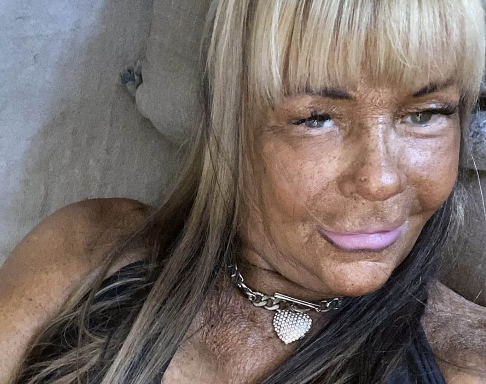revistapazes.com - Ela virou not&iacute;cia por um bronzeado extremo; anos depois, Patricia Krentcil reaparece diferente