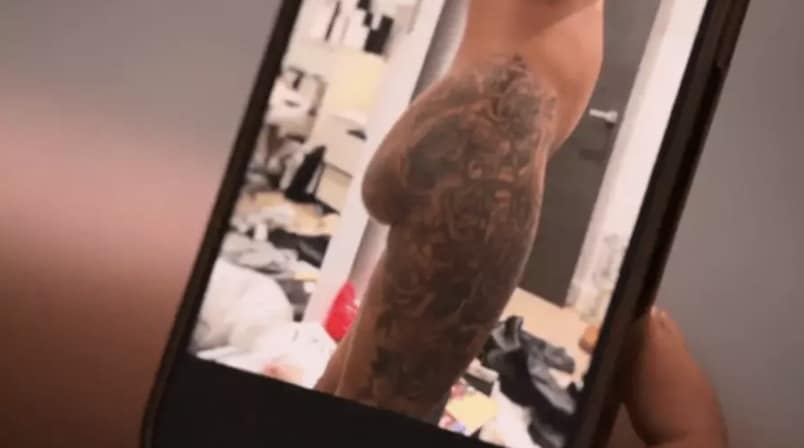 revistapazes.com - Influencer se v&ecirc; obrigada a gastar R$ 500 mil em cirurgia corretiva ap&oacute;s implante no bumbum se deslocar