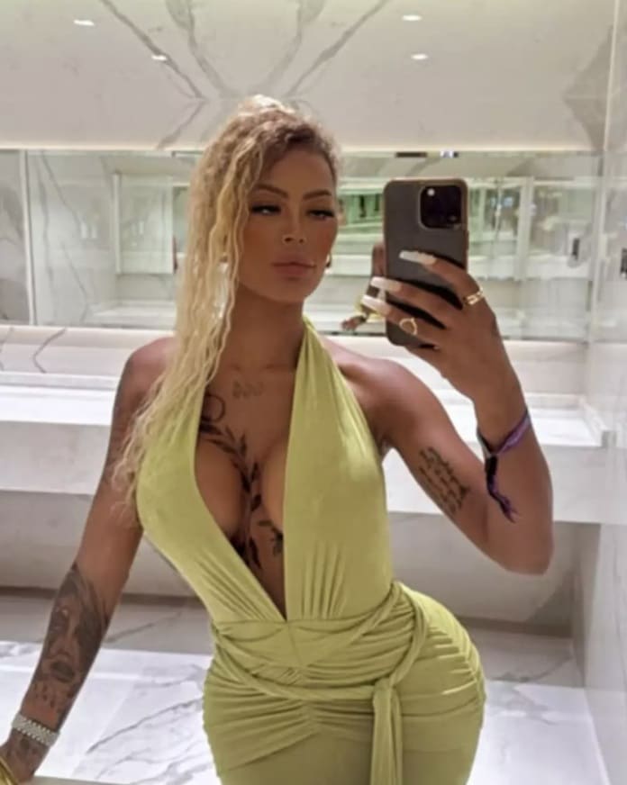 revistapazes.com - Influencer se v&ecirc; obrigada a gastar R$ 500 mil em cirurgia corretiva ap&oacute;s implante no bumbum se deslocar