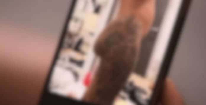 Influencer se vê obrigada a gastar R$ 500 mil em cirurgia corretiva após implante no bumbum se deslocar