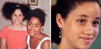 Ela nunca se considerou bonita e quase perdeu a vida… Hoje é esposa de um milionário e querida por milhões