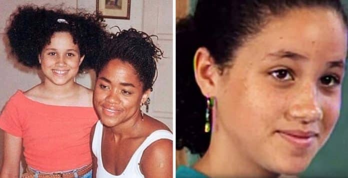 Ela nunca se considerou bonita e quase perdeu a vida… Hoje é esposa de um milionário e querida por milhões