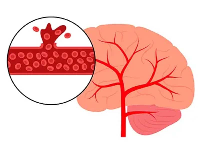 revistapazes.com - Ele tomou banho logo ap&oacute;s comer e a rea&ccedil;&atilde;o do seu corpo acabou virando alerta